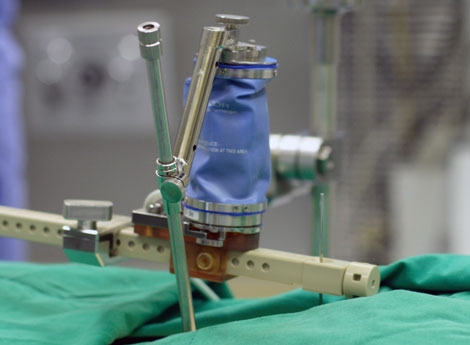 The Easier, 3D Way to Spine Surgery