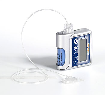 Israeli Made Insulin Pump Wows EU