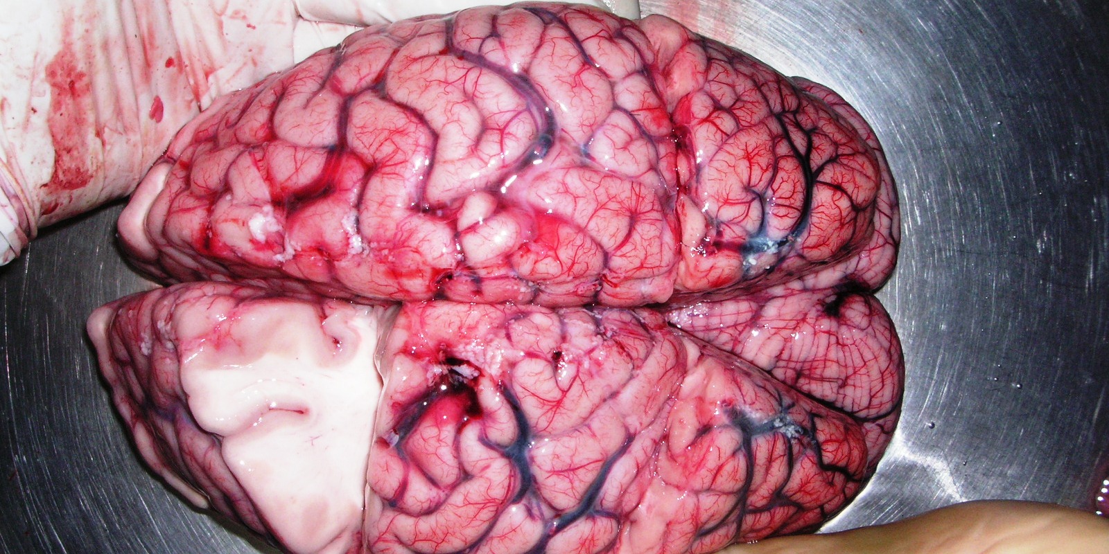 Israeli Study Has New Options For Brain Damage Treatment