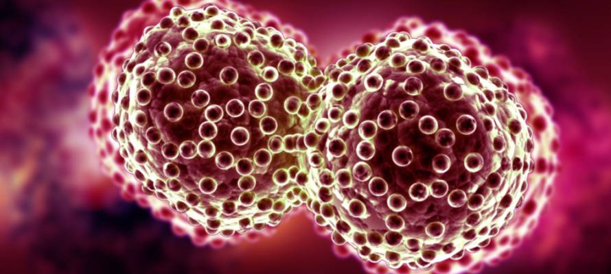 Israeli Scientist Trick Cancer Cells to Self Destruct